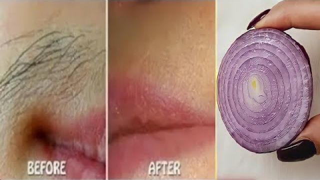 Stop shaving! Here's how to permanently get rid of facial, body and pubic hair