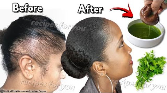 Your hair will grow 5 times faster,🌿Get rid of baldness quickly, A final solution