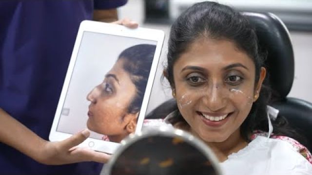 Young Pretty Girl Rhinoplasty Surgery in India - Day 7 - Nose Pack Removal